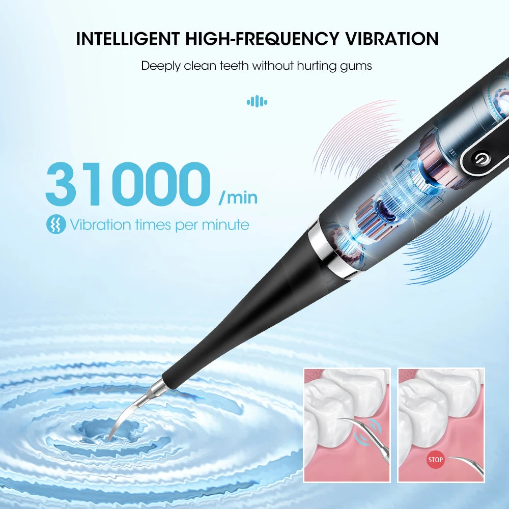 Electric Teeth Whitening Dental Calculus Scaler Plaque Coffee Stain Tartar Removal High Frequency Sonic Toothbrush Teeth Cleaner