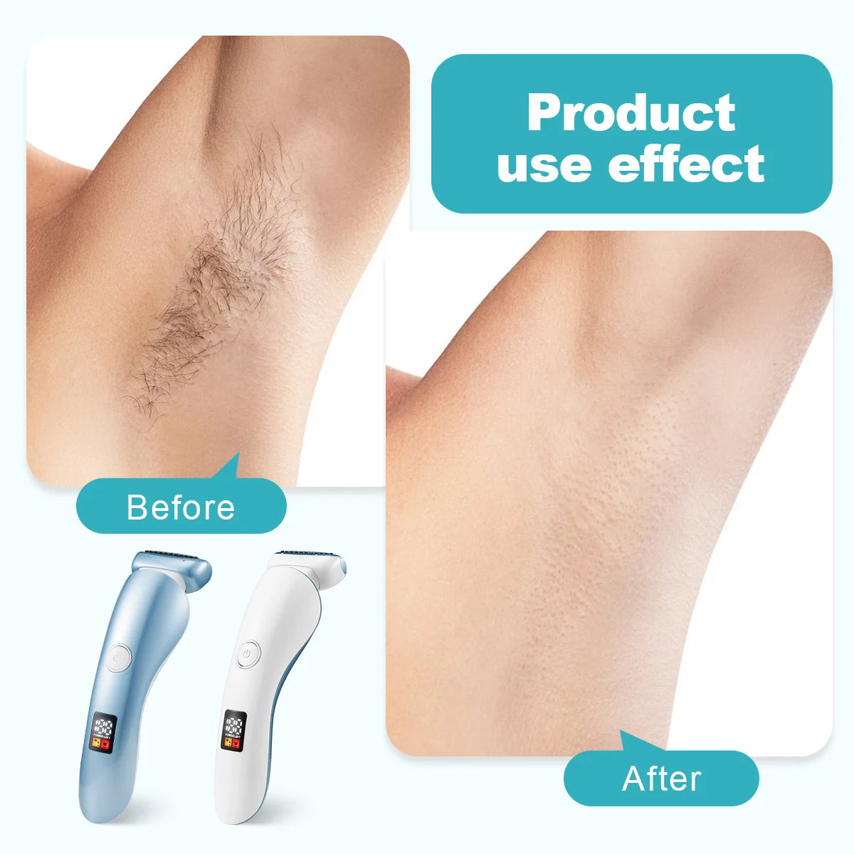 5-in-1 Women's Electric Shaver - Wet and Dry Removal of Face, Eyebrows, Legs and Armpits - Portable Bikini Trimmer, Rechargeable USB Charging, Stainless Steel Blade, Gentle and Effective Shaving, Pink Gift Box Includes, Bikin