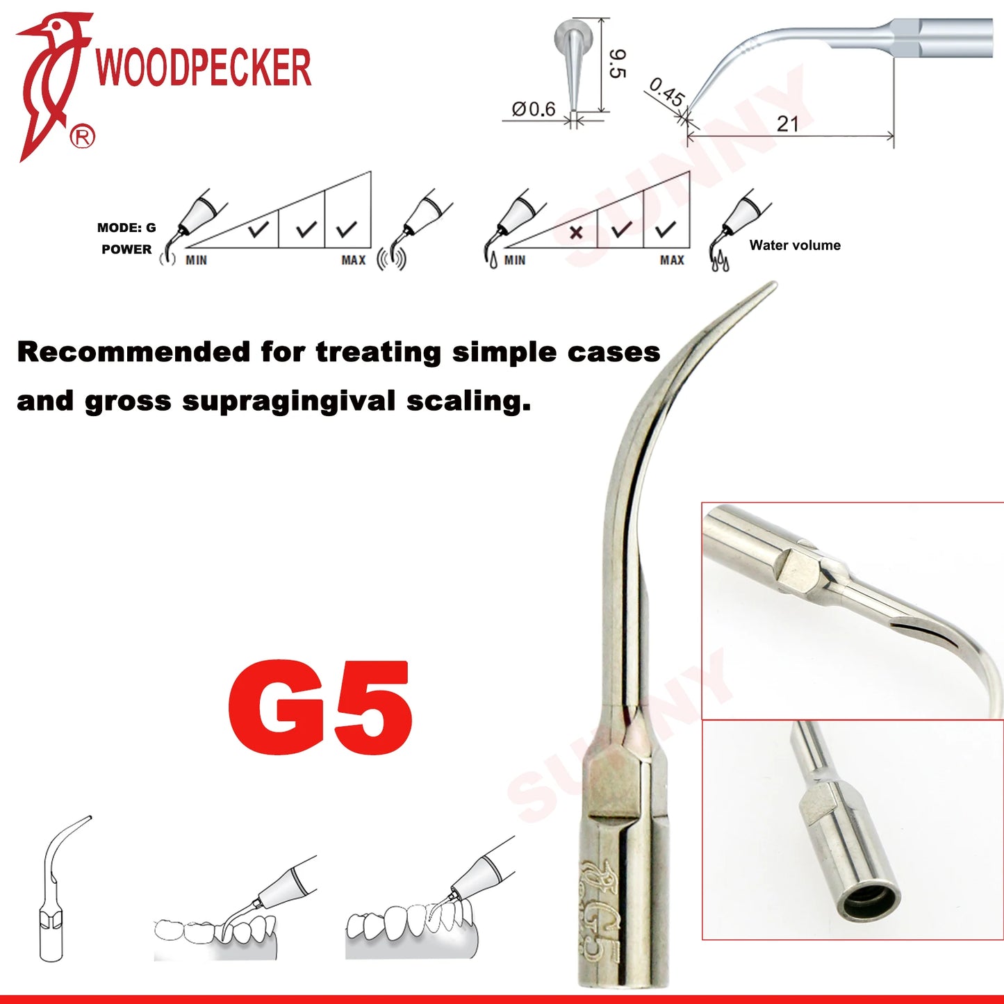 Woodpecker Dental Scaler Tips Ultrasonic Tooth Cleaning Machine Cutter Head Endo Perio Scaling Tips Fit EMS UDS Scaler Handpiece