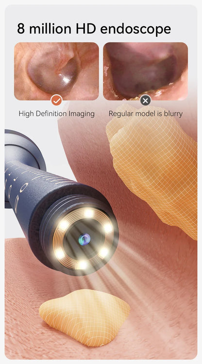 Upgraded Smart Visual Ear Wax Cleaner With Camera 800W HD Endoscope Multi-Functional Visual Ear Cleaning Tool Includes Storage