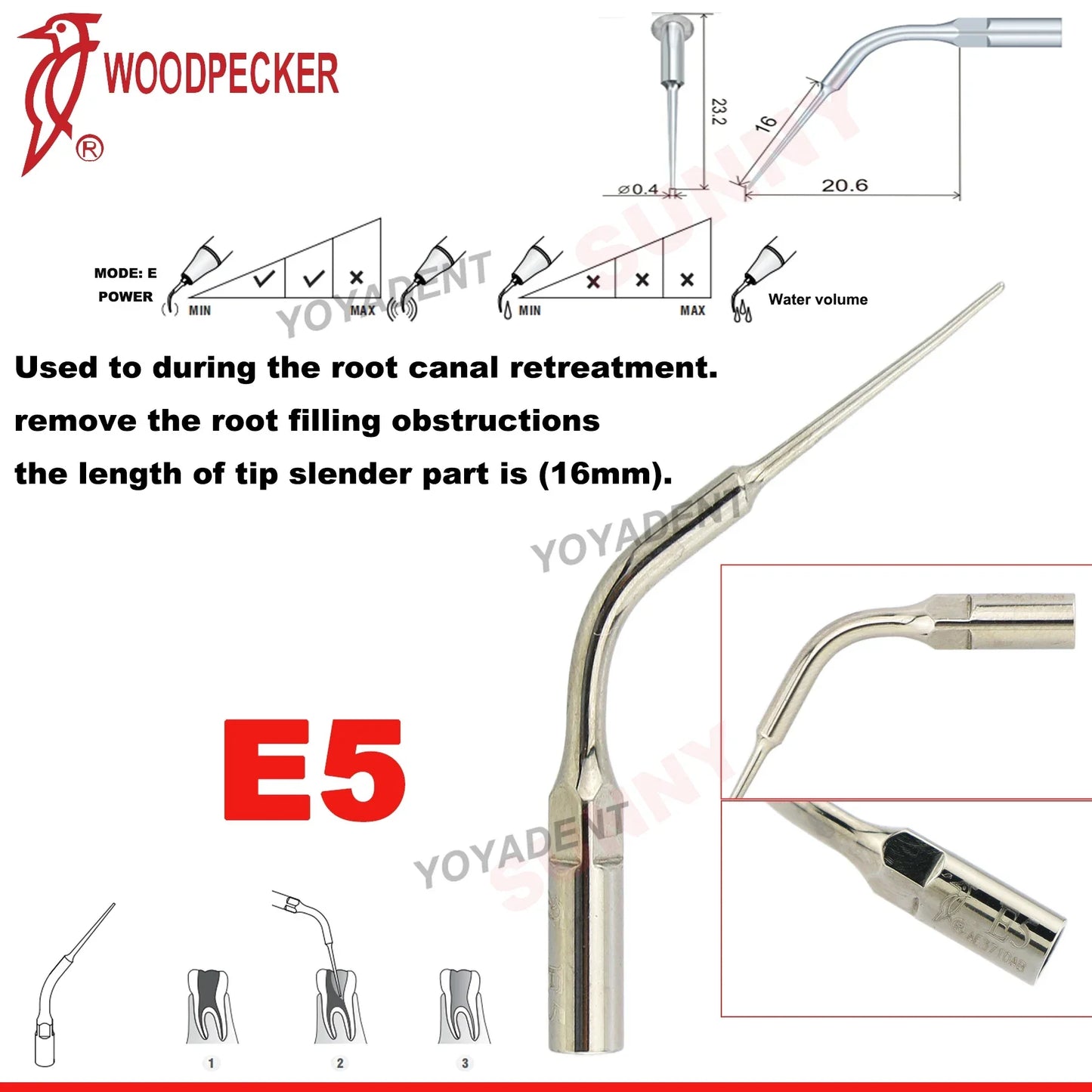 Woodpecker Dental Scaler Tips Ultrasonic Tooth Cleaning Machine Cutter Head Endo Perio Scaling Tips Fit EMS UDS Scaler Handpiece