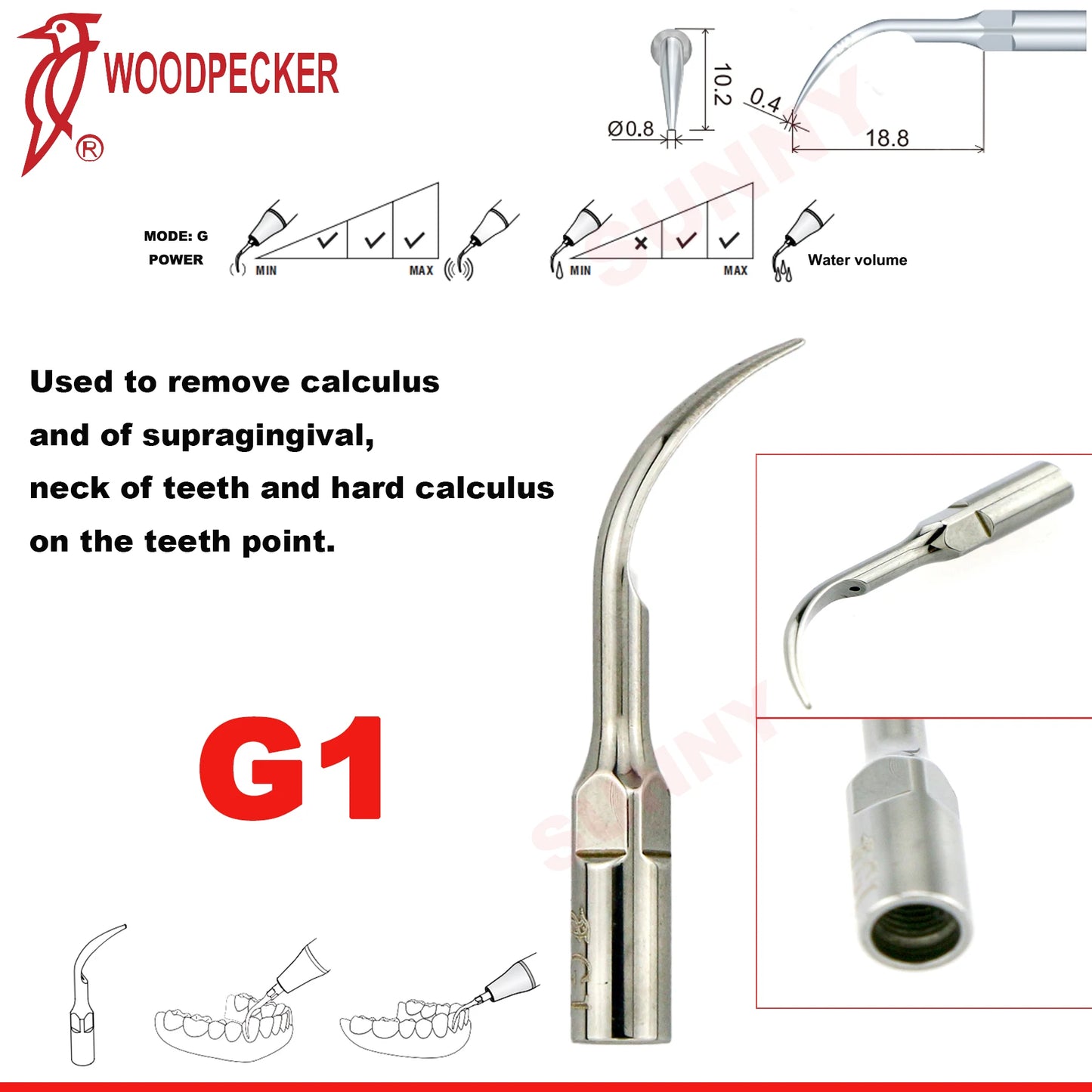 Woodpecker Dental Scaler Tips Ultrasonic Tooth Cleaning Machine Cutter Head Endo Perio Scaling Tips Fit EMS UDS Scaler Handpiece
