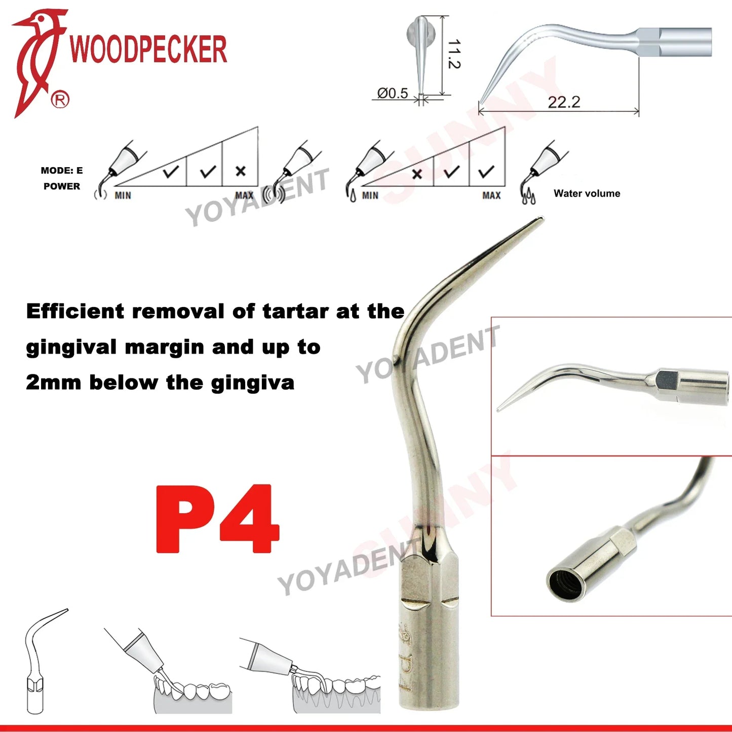 Woodpecker Dental Scaler Tips Ultrasonic Tooth Cleaning Machine Cutter Head Endo Perio Scaling Tips Fit EMS UDS Scaler Handpiece