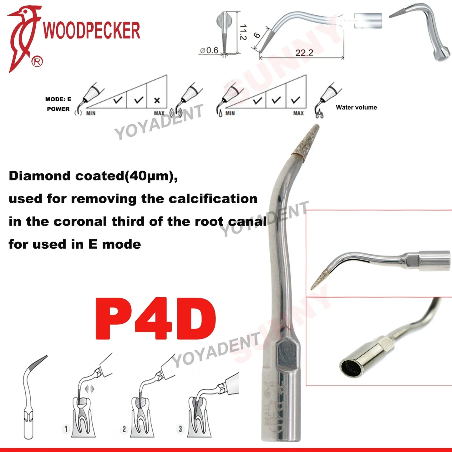 Woodpecker Dental Scaler Tips Ultrasonic Tooth Cleaning Machine Cutter Head Endo Perio Scaling Tips Fit EMS UDS Scaler Handpiece