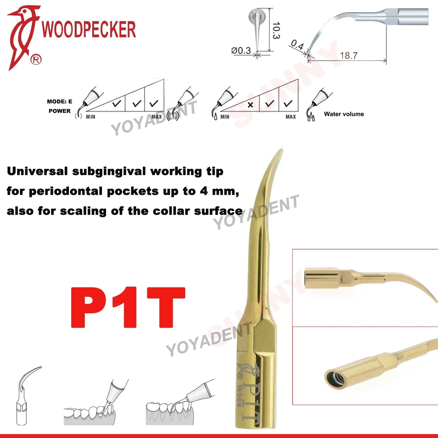 Woodpecker Dental Scaler Tips Ultrasonic Tooth Cleaning Machine Cutter Head Endo Perio Scaling Tips Fit EMS UDS Scaler Handpiece