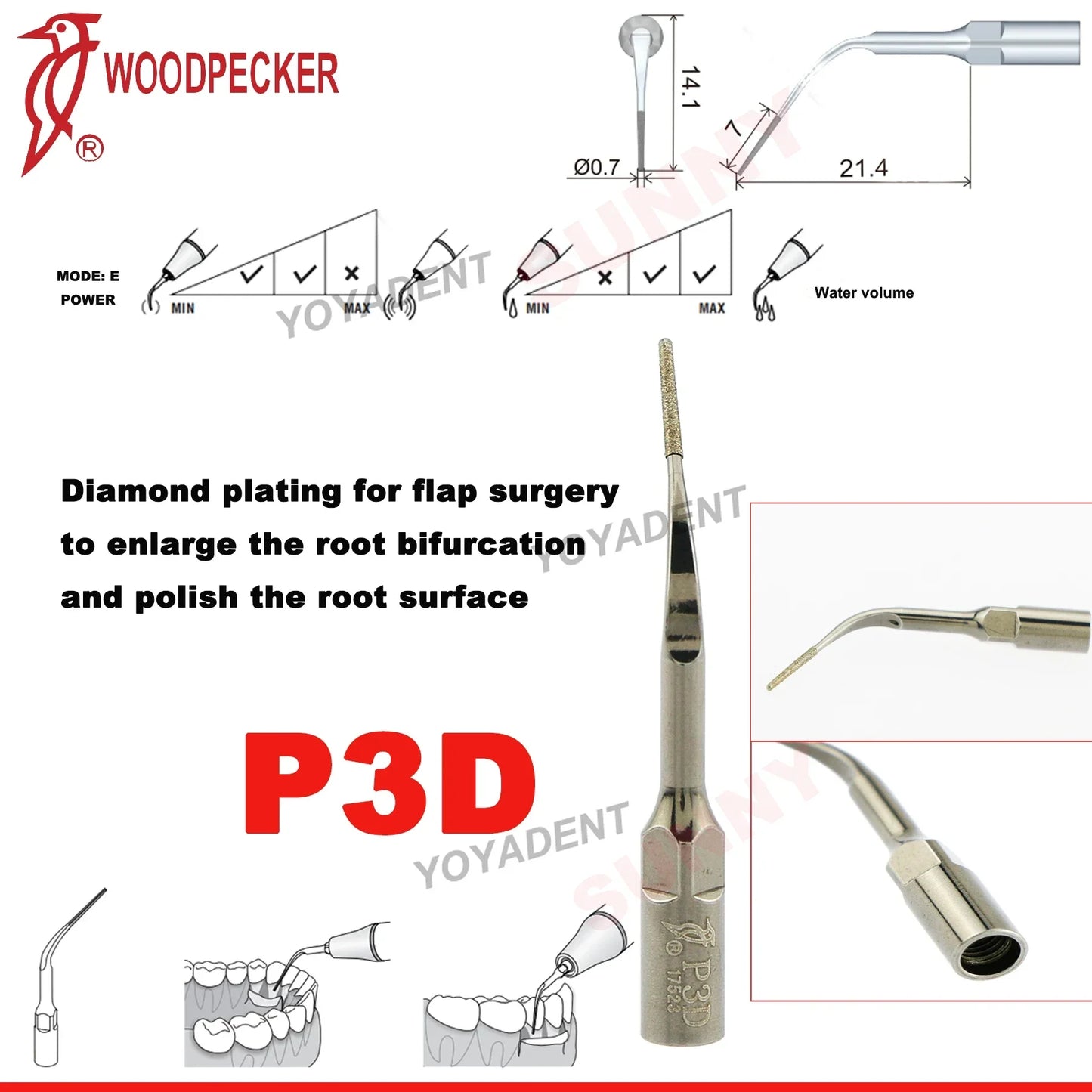 Woodpecker Dental Scaler Tips Ultrasonic Tooth Cleaning Machine Cutter Head Endo Perio Scaling Tips Fit EMS UDS Scaler Handpiece