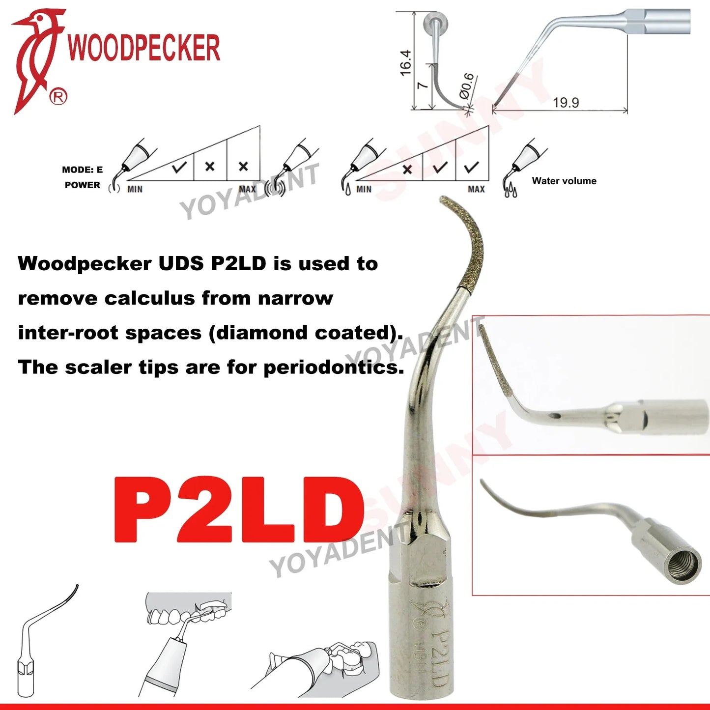 Woodpecker Dental Scaler Tips Ultrasonic Tooth Cleaning Machine Cutter Head Endo Perio Scaling Tips Fit EMS UDS Scaler Handpiece