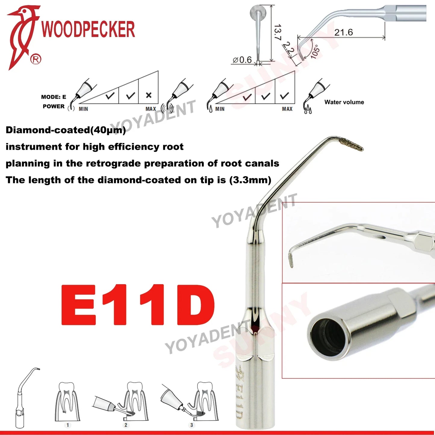 Woodpecker Dental Scaler Tips Ultrasonic Tooth Cleaning Machine Cutter Head Endo Perio Scaling Tips Fit EMS UDS Scaler Handpiece