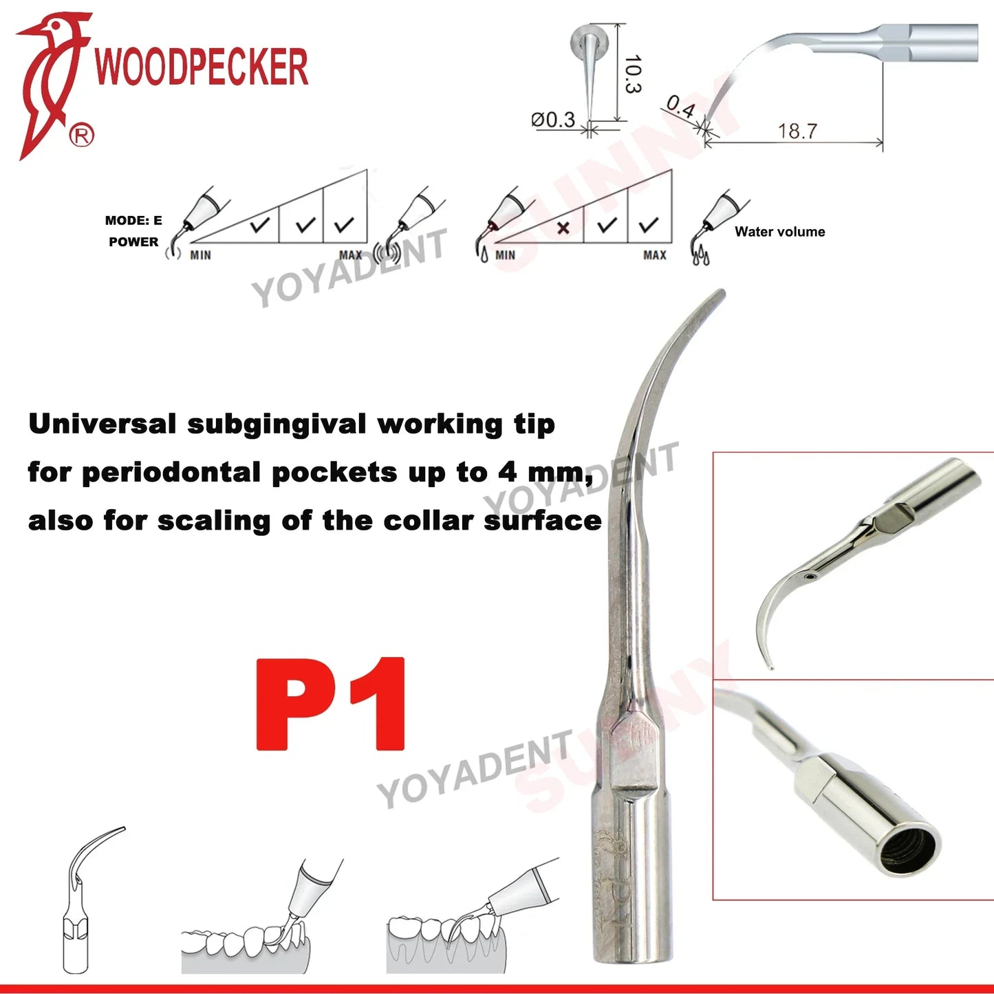 Woodpecker Dental Scaler Tips Ultrasonic Tooth Cleaning Machine Cutter Head Endo Perio Scaling Tips Fit EMS UDS Scaler Handpiece
