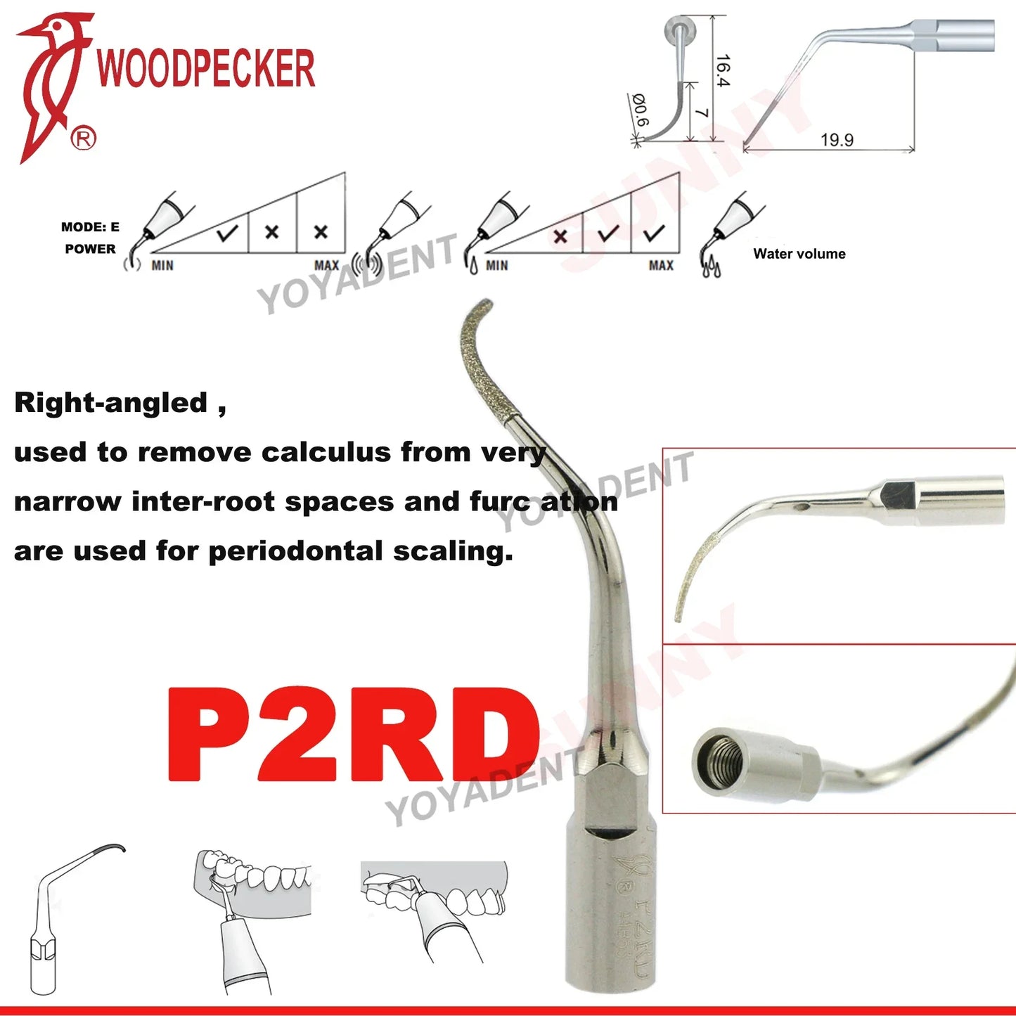 Woodpecker Dental Scaler Tips Ultrasonic Tooth Cleaning Machine Cutter Head Endo Perio Scaling Tips Fit EMS UDS Scaler Handpiece